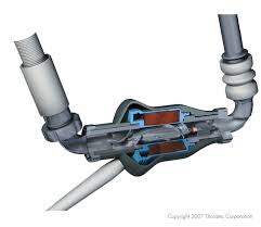 Ventricular Assist Device Surgery-1