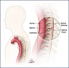 Angiography-1