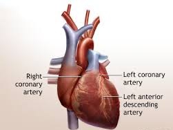 Cardiac artery bypass graft surgery -11
