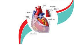 Mitral Valve repair Surgery in India-1