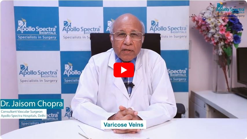 dr jaisom chopra vascular surgeon in delhi