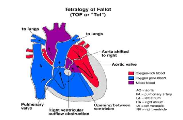 tetrology failot