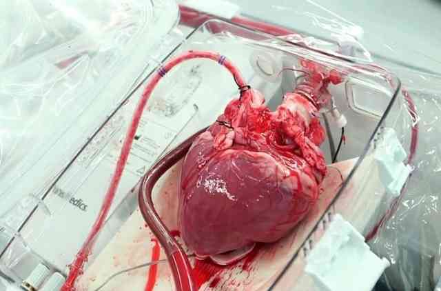 ventilateur cardiaque