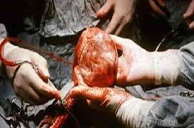 Хирургия врожденных пороков сердца