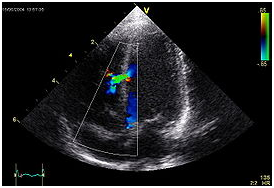 Echocardiography2