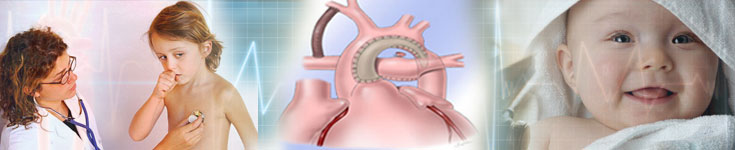 Why You Should Consider Norwood Procedure in India for Hypoplastic Left Heart Syndrome