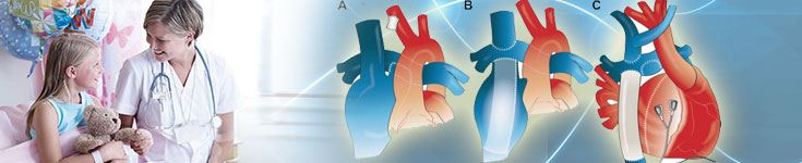 Single Ventricle Anomalies and Fontan Circulation Get Best Procedures in India