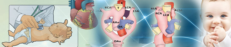 Vascular Rings in India Why You Should Undergo the Surgical Procedure in India