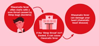 Affordable Rheumatic Heart Disease Treatment in India