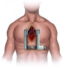 Open Heart Surgery Best Mitral Valve Repair Surgeon In India