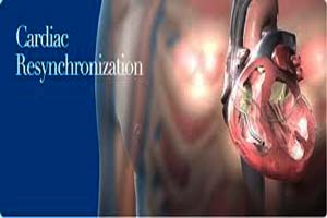 Cardiac Resynchronization Therapy Cost in India