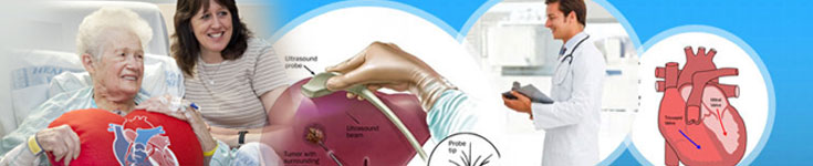Catheter Ablation Surgical Treatment In India