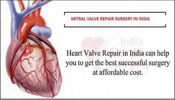 Cost of Mitral Valve Repair in India