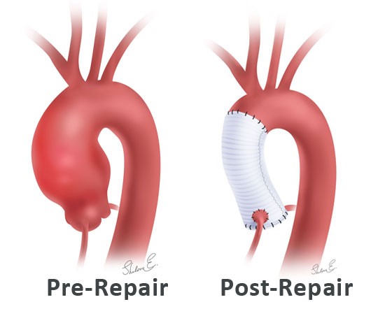 pré-réparation et post-réparation