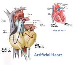 Top Cardiac Surgeons For Left Ventricular Assist Device (ВАД)