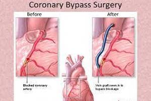 Top Cardiomegaly Treatment Hospitals in India