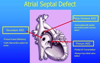 Top Congenital Septal Defects Treatment Hospitals in India