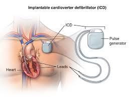 Top hospitals for Electrophysiology