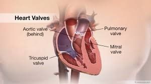 chirurgie de remplacement de la valve cardiaque en Inde